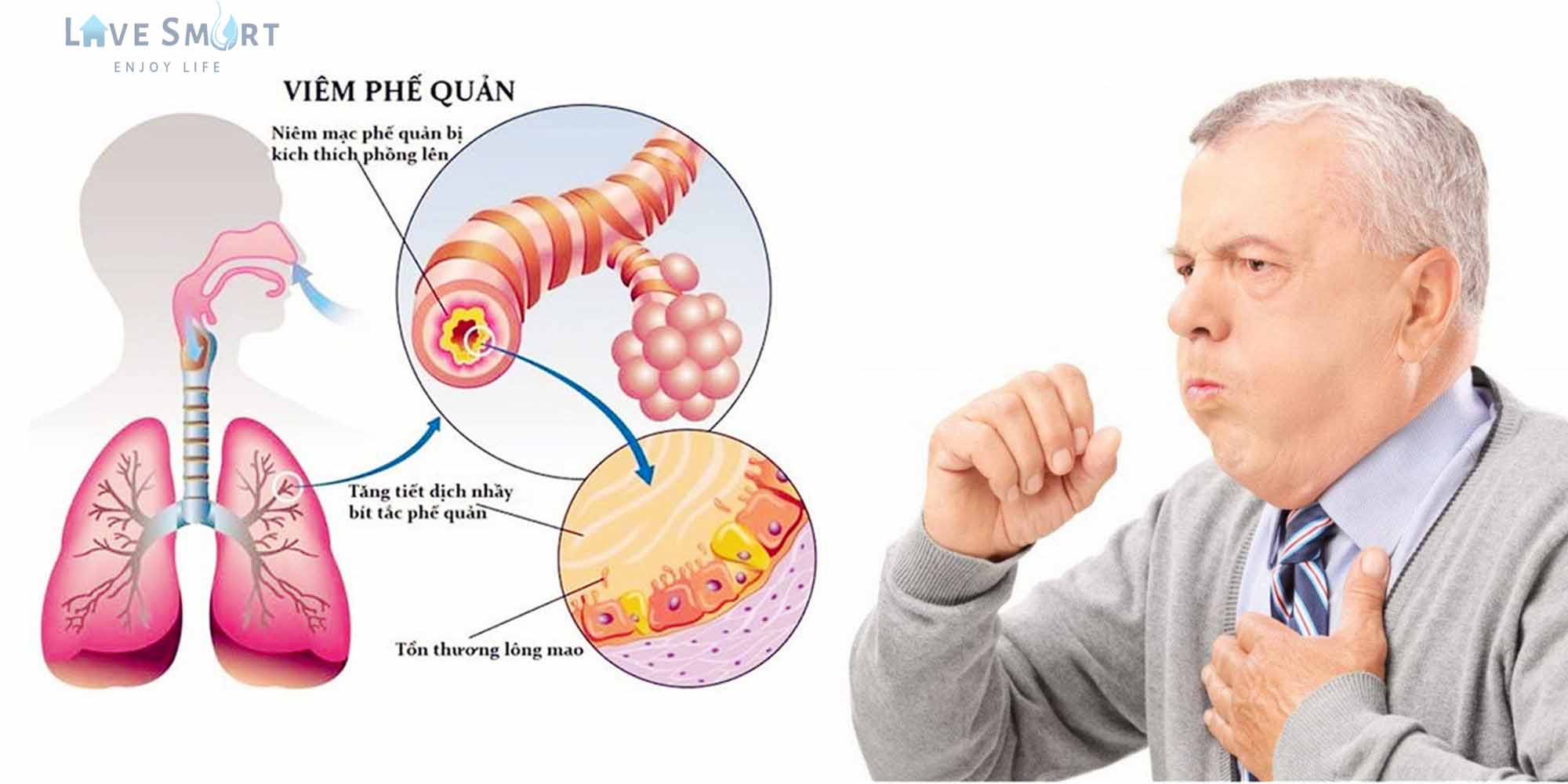 triệu chứng của bệnh viêm phế quản